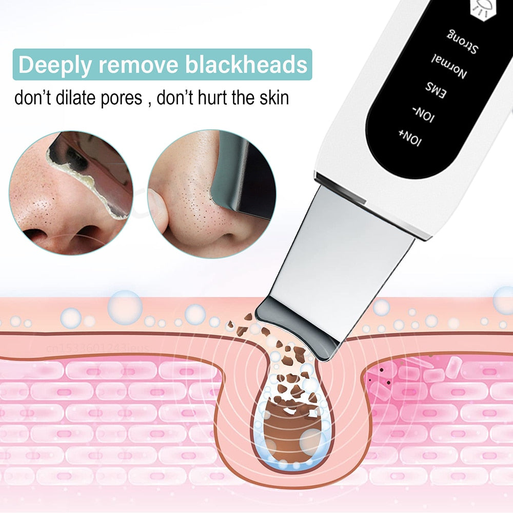 GlowWave Ultraschall Hautreiniger - GlidySkin