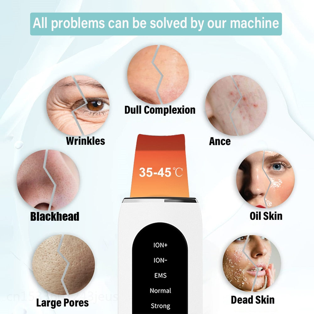 GlowWave Ultraschall Hautreiniger - GlidySkin