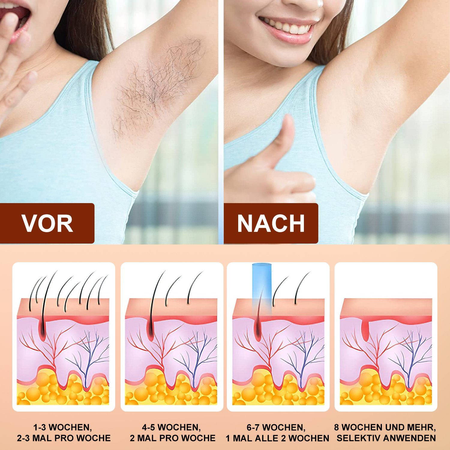 IPL Laser Haarentferner - GlidySkin